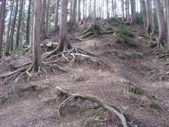 骨折した場所